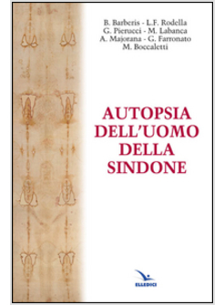 AUTOPSIA DELL'UOMO DELLA SINDONE